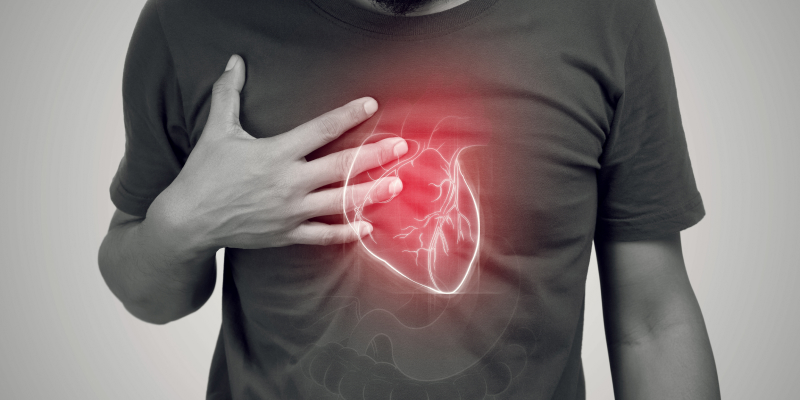 Heart Failure Management